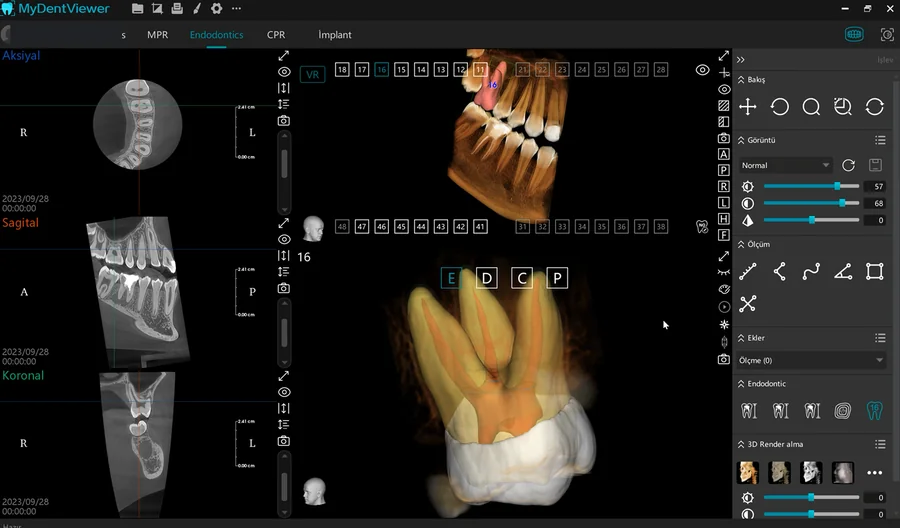 Meyer 3D Pro, görünüm 2