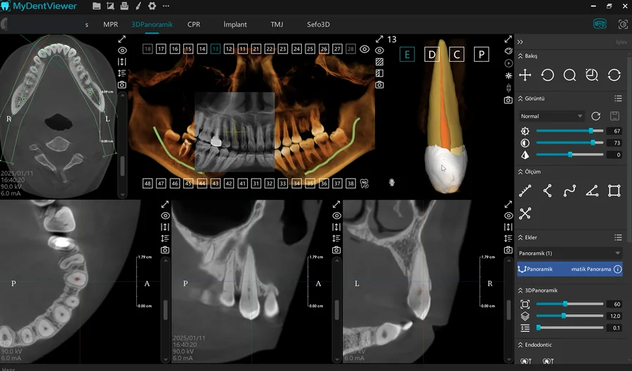 Meyer 3D Pro, görünüm 7