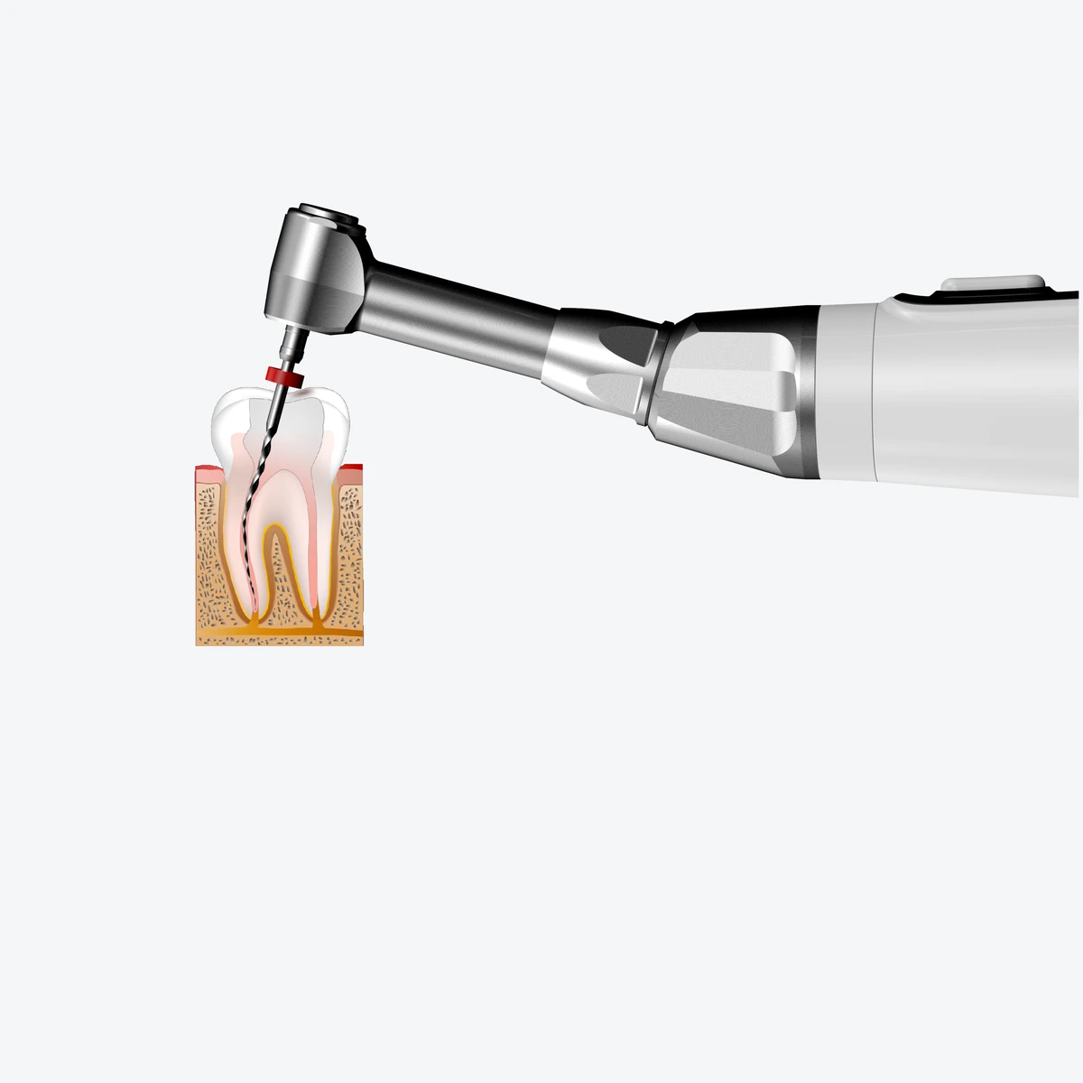 Woodpecker E-Com Endo Motor, görünüm 3